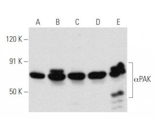 Sc 166887 PE PAK A 6 PE Clinisciences