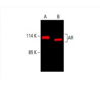 Androgen Receptor Antibody (441) - Western Blotting - Image 394021 