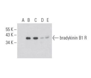 bradykinin B1 R Antibody (F-11) - Western Blotting - Image 397677