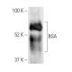 BSA Antibody (2A3E6) - Western Blotting - Image 12261 