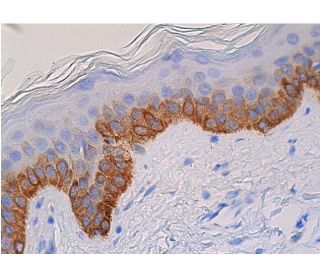 Cytokeratin 14 Antibody (LL001) - Immunohistochemistry - Image 361375 