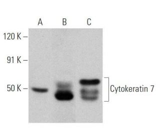 Cytokeratin 7 Antibody (RCK105) - Western Blotting - Image 356323 