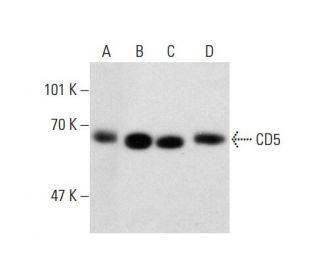 CD5 Antibody (CD5/54/F6) - Western Blotting - Image 137855 