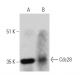 Cdc28 Antibody (G-7) - Western Blotting - Image 363284