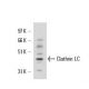 Clathrin Light Chain Antibody (3F133) - Western Blotting - Image 17544 