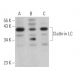 Clathrin Light Chain Antibody (3F133) - Western Blotting - Image 363920