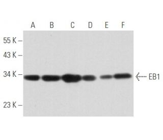 EB1 Antibody (1A11/4) - Western Blotting - Image 356672 