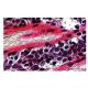 Eosin Y: sc-203734 and Hematoxylin: sc-24973. Staining of formalin-fixed, paraffin-embedded human breast tissue showing cy 