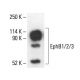 EphB1/2/3 Antibody (EfB1-3) - Western Blotting - Image 411195 