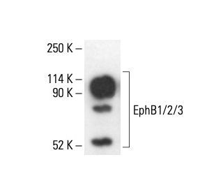 EphB1/2/3 Antibody (EfB1-3) - Western Blotting - Image 411195 