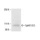 EphB1/2/3 Antibody (EfB1-3) - Western Blotting - Image 411749