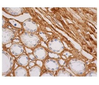 Fibronectin Antibody (P5F3) - Immunohistochemistry - Image 349139 