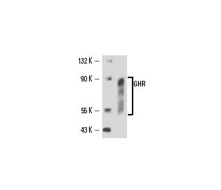 GHR Antibody (MAB 1) - Western Blotting - Image 16383