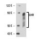 GHR Antibody (MAB 1) - Western Blotting - Image 16383