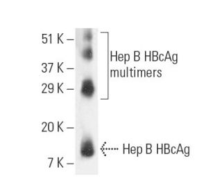 Hep B cAg Antibody (C1-5) - Western Blotting - Image 9592