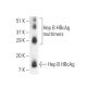 Hep B cAg Antibody (C1-5) - Western Blotting - Image 9592