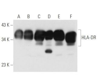 HLA-DR Antibody (TAL 1B5) - Western Blotting - Image 13571 