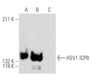 HSV-1 ICP8 Antibody (11E2) - Western Blotting - Image 13576