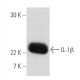 IL-1 beta/IL1B Antibody (B122) - Western Blotting - Image 2609 