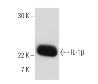 IL-1 beta/IL1B Antibody (B122) - Western Blotting - Image 2609 