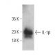 IL-1 beta/IL1B Antibody (B122) - Western Blotting - Image 396091