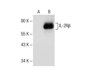 IL-2R&beta; Antibody (D-12) - Western Blotting - Image 151709