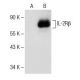 IL-2Rβ Antibody (D-12) - Western Blotting - Image 151709