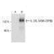 IL-3/IL-5/GM-CSFRβ Antibody (B-9) - Western Blotting - Image 157466