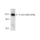 IL-3/IL-5/GM-CSFRβ Antibody (B-9) - Western Blotting - Image 303439 