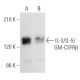 IL-3/IL-5/GM-CSFRβ Antibody (B-9) - Western Blotting - Image 354963 