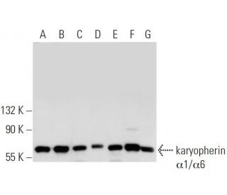 karyopherin &alpha;1/6 Antibody (2D9) - Western Blotting - Image 19920 