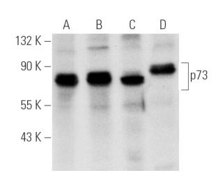 p73 Antibody (E-4) - Western Blotting - Image 27 