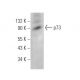 p73 Antibody (E-4) - Western Blotting - Image 375151