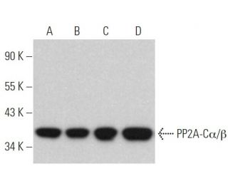 PP2A-C&alpha;/&beta; Antibody (0.T.118) - Western Blotting - Image 370858 