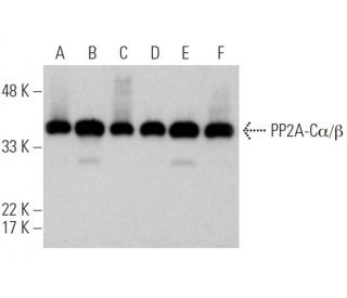 PP2A-C&alpha;/&beta; Antibody (1D6) - Western Blotting - Image 368015 