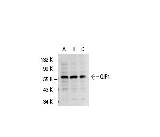 QIP1 Antibody (3D10) - Western Blotting - Image 19924 