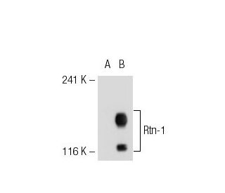 Rtn-1/2 Antibody (4A69) - Western Blotting - Image 39242