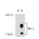 Rtn-1/2 Antibody (4A69) - Western Blotting - Image 39242