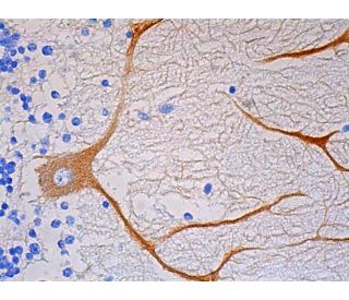 Rtn-1/2 Antibody (RNL-2) - Immunohistochemistry - Image 391886 