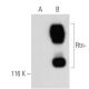 Rtn-1A Antibody (MON161) - Western Blotting - Image 39236