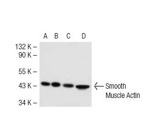 Smooth Muscle Actin Antibody (B4) - Western Blotting - Image 41390 