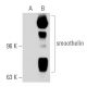 smoothelin Antibody (R4A) - Western Blotting - Image 42277 