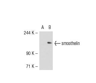 smoothelin Antibody (R4A) - Western Blotting - Image 55458 