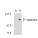 smoothelin Antibody (R4A) - Western Blotting - Image 55458 