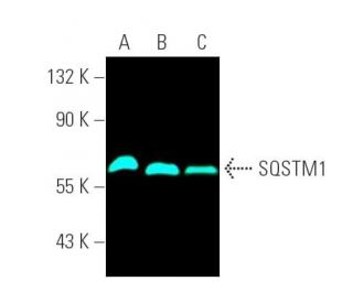 SQSTM1 Antibody (D-3) - Western Blotting - Image 391497 