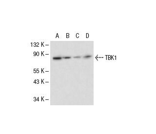 TBK1 Antibody (108A429) - Western Blotting - Image 17593 