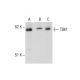 TBK1 Antibody (108A429) - Western Blotting - Image 287543