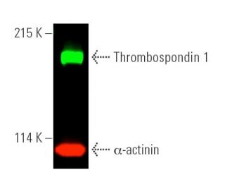 Thrombospondin 1 Antibody (A6.1) - Western Blotting - Image 389992 