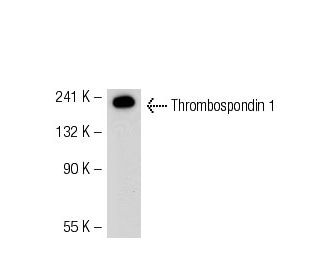 Thrombospondin 1 Antibody (MS-421) - Western Blotting - Image 50643