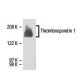 Thrombospondin 1 Antibody (SPM321) - Western Blotting - Image 18125